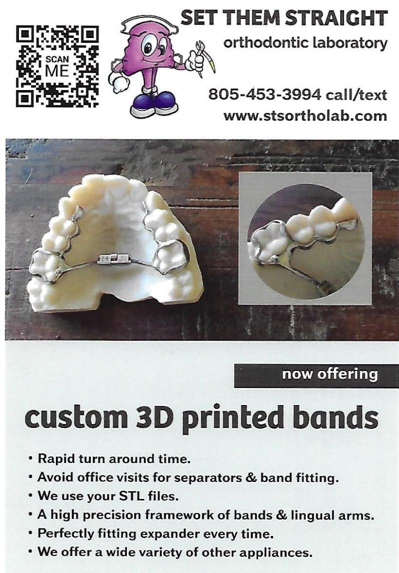 Now offering custom 3D printed bands